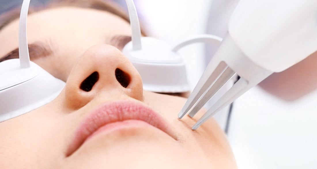 Laser treatments for younger looking skin: dos and don'ts